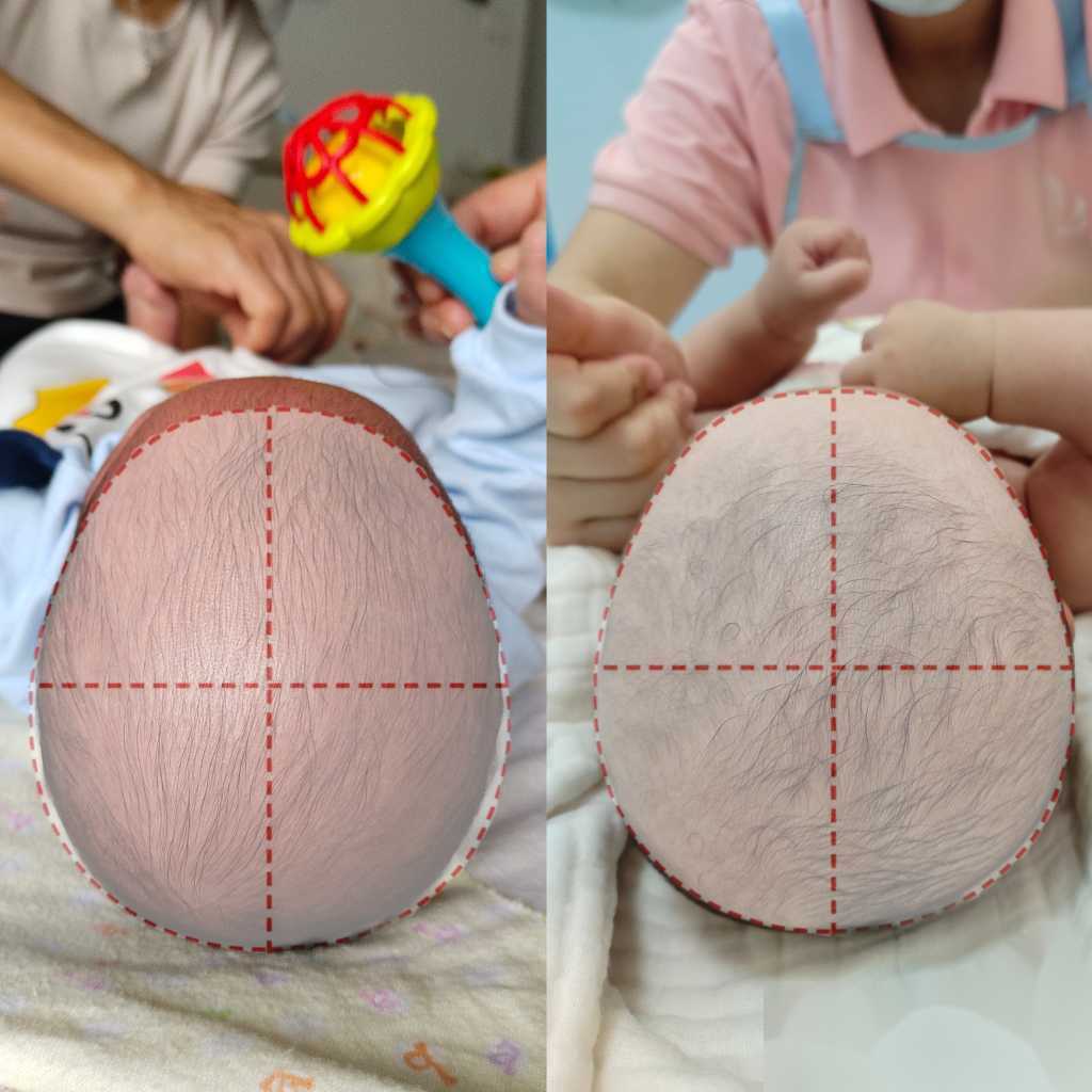 正规借卵试管,女性绝经了还能做泰国试管婴儿助孕吗？