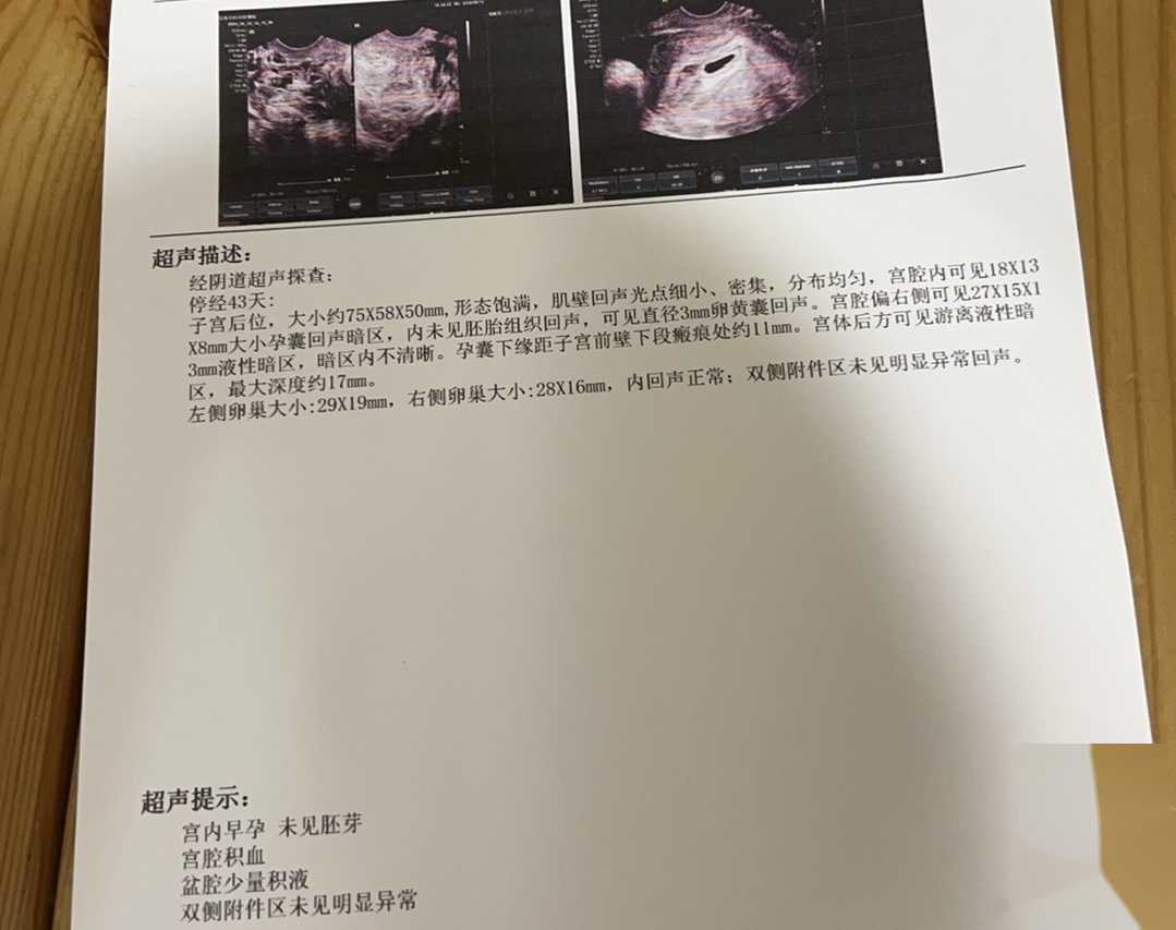 试管代怀生子多少钱，附试管费用明细！