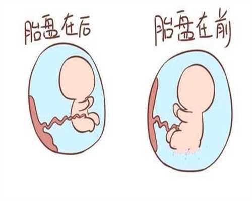 中国代孕中心_双胞胎可以嫁一人吗