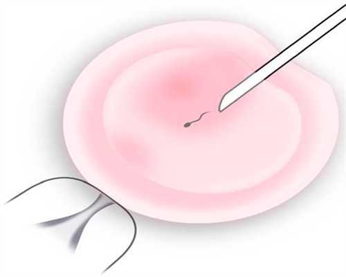 代孕网-代孕网多少费用-胎儿娩出后脐带怎么办